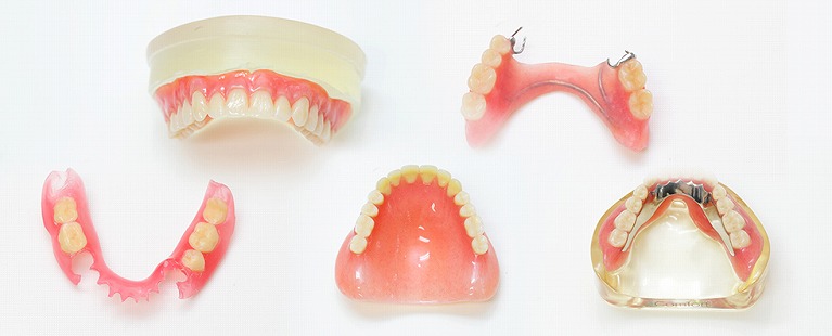 入れ歯には種類がたくさんあります！